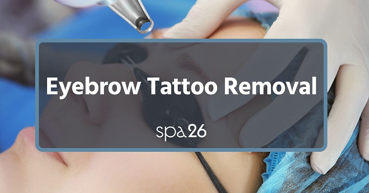 Eyebrow Tattoo Removal
