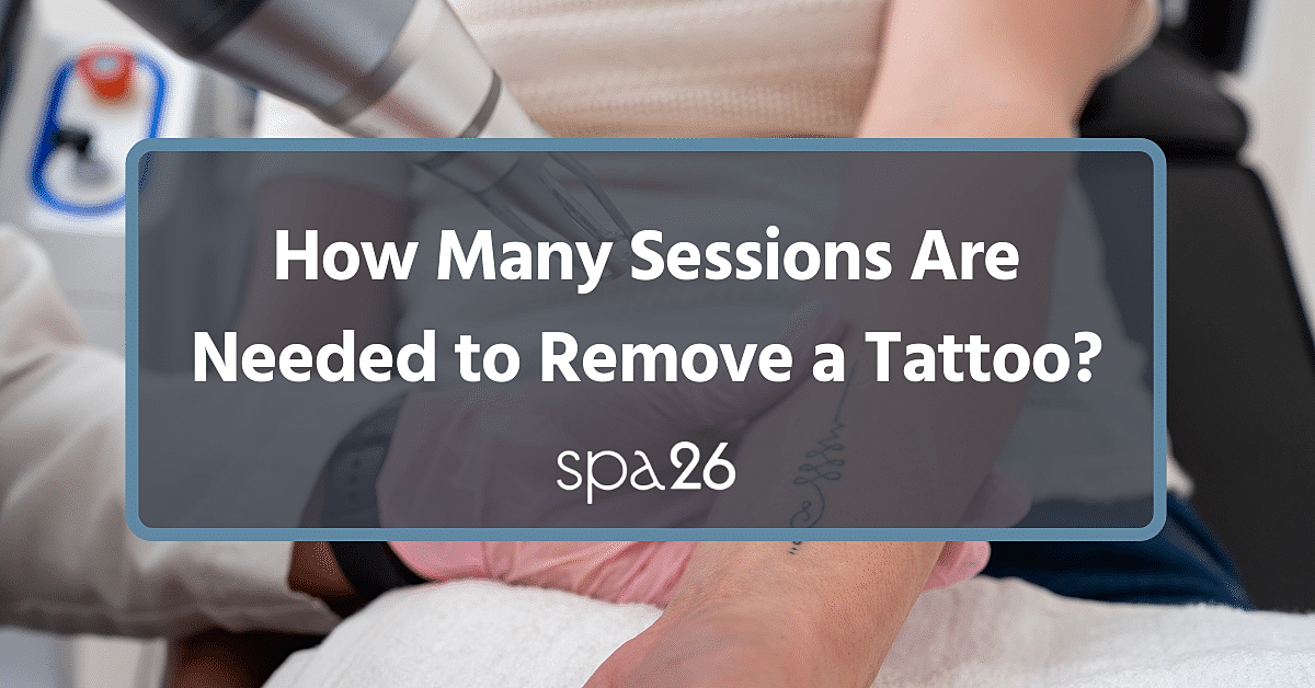 How Many Sessions Are Needed to Remove a Tattoo?