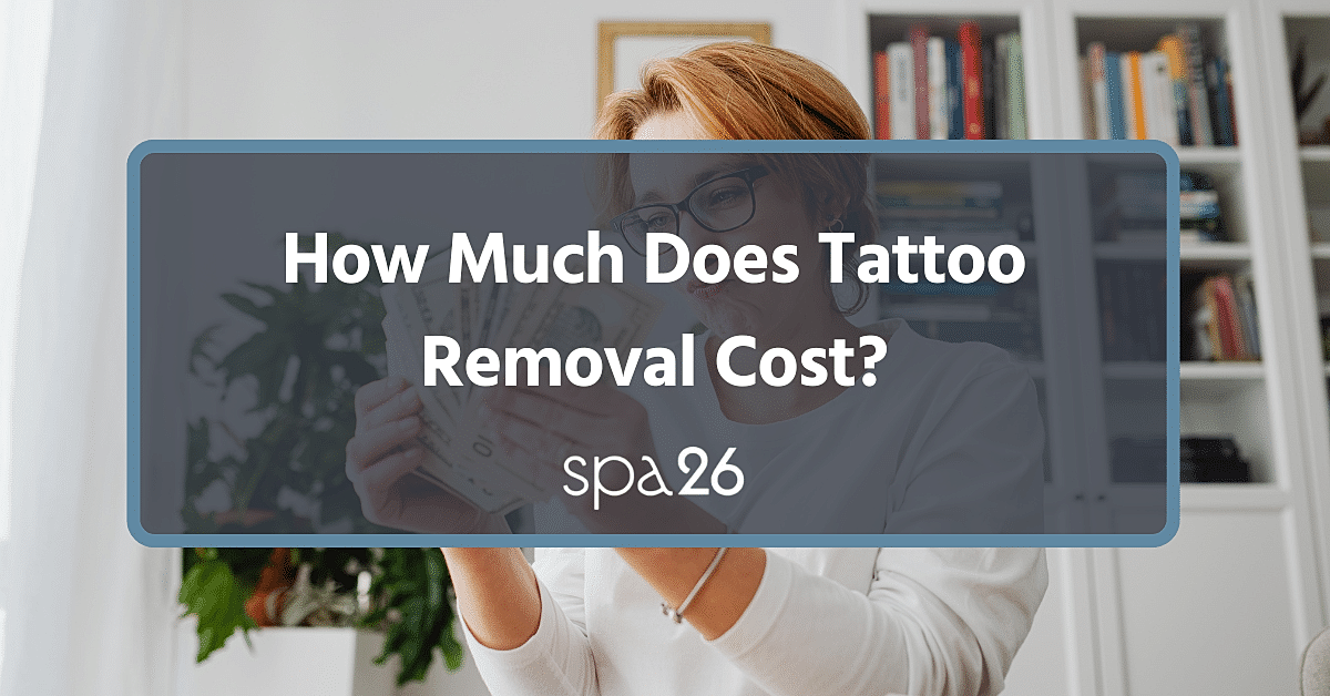 How Much Does Tattoo Removal Cost?