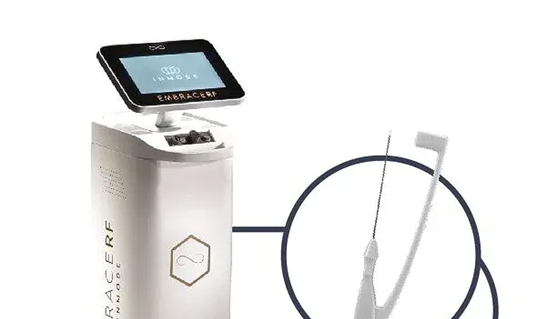 EmbraceRF device for aesthetic procedures and treatments.