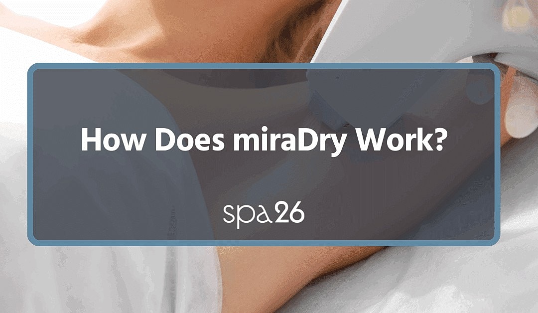 miraDry treatment process explanation graphic