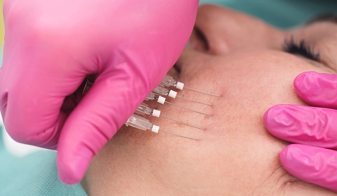 Skin treatment with needles and gloved hands.