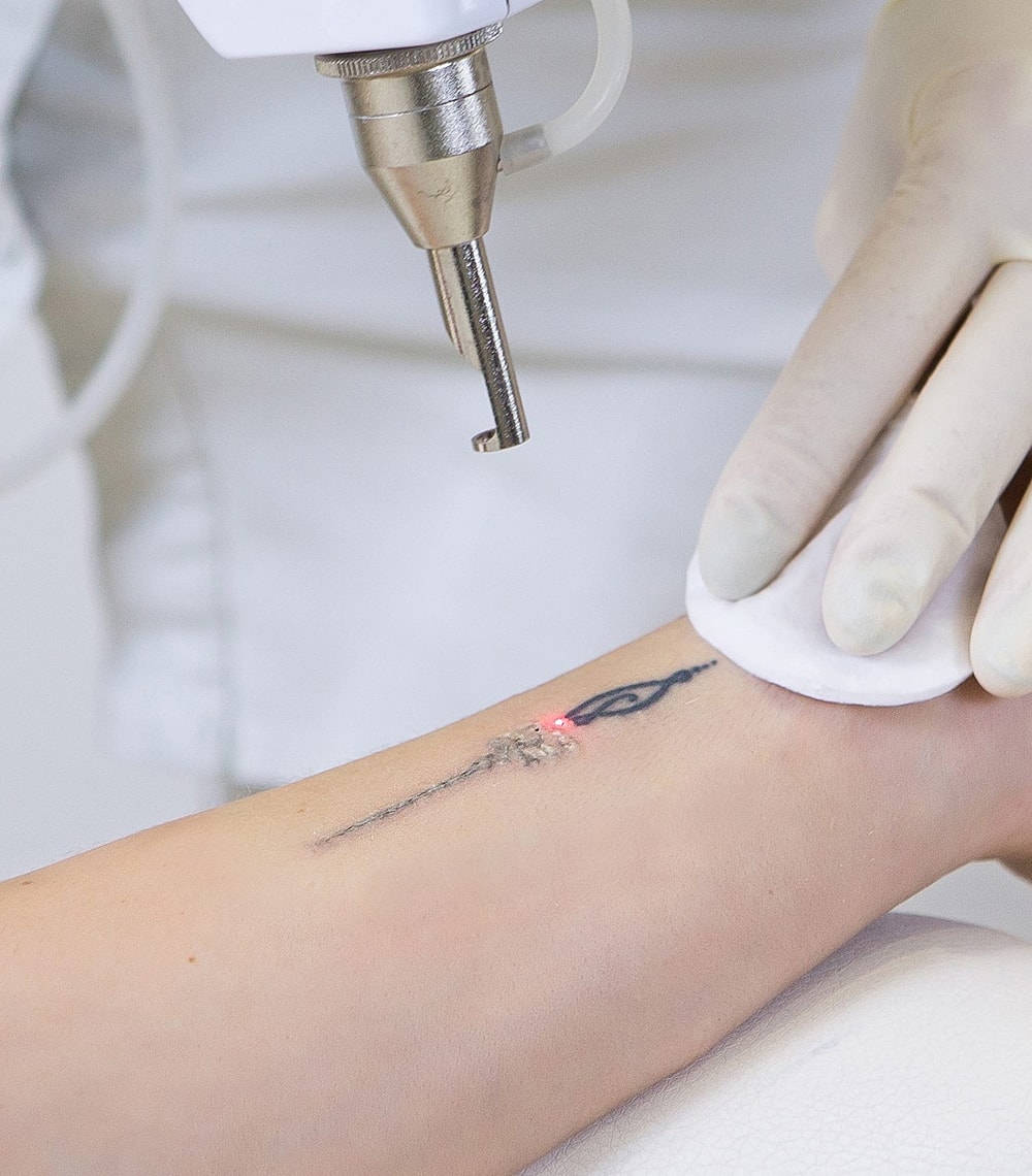 Woman in black leggings outdoors, focused on legs.