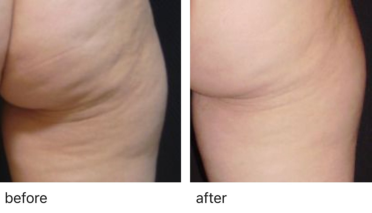 Before and after images of skin appearance.