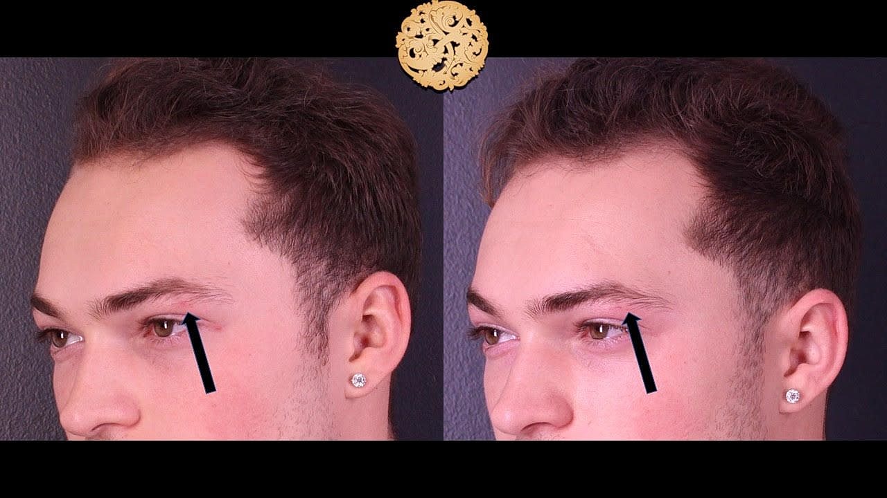 Laser Gallery Before & After