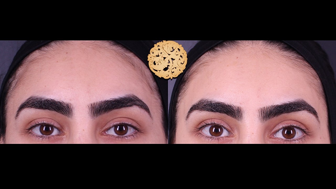 Skin Rejuvenation Gallery Before & After