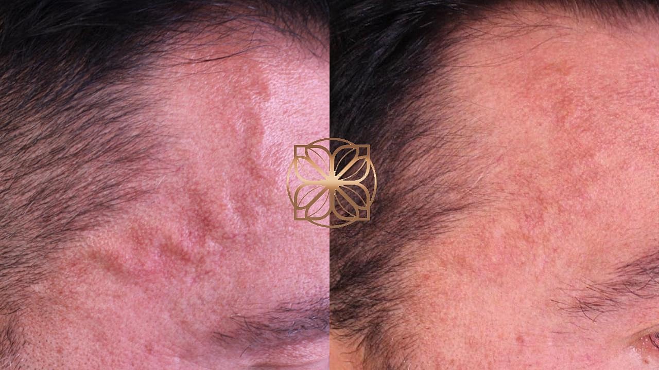 Injectables Gallery Before & After