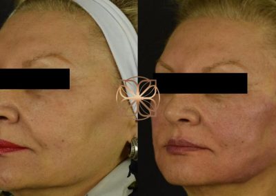 Threading Spa26 Beverly Hills