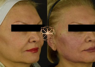 Threading Spa26 Beverly Hills