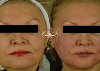 Threading Spa26 Beverly Hills