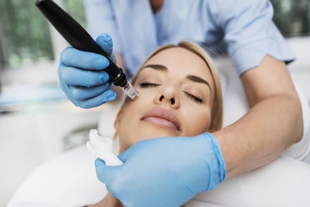 Side Effects & Risks for microneedling prp