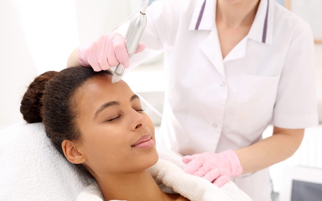 Microneedling with PRP Beverly Hills