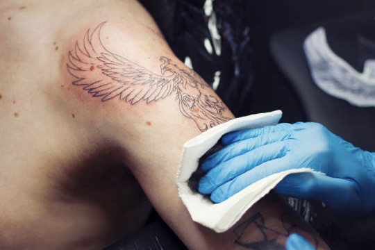 Tattoo Removal Similar Procedures