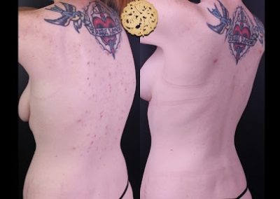 Flawless Facial Before and After 3