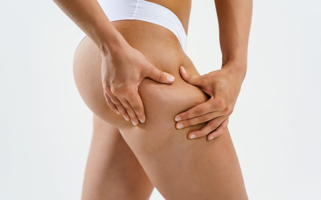 QWO Cellulite Treatment Beverly Hills