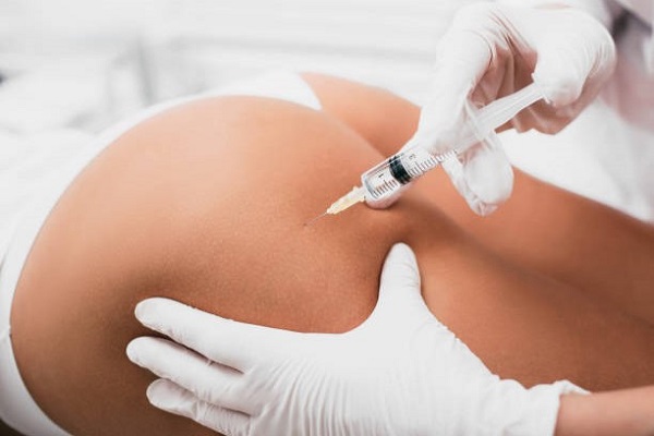 Practitioner injects fillers to patient's buttock
