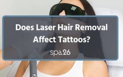 Does Laser Hair Removal Affect Tattoos?