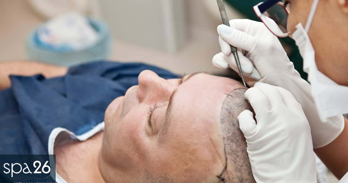 Is Hair Transplant Covered by Insurance?